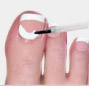 Using EmoniNAIL Step 3 EmoniNail™ - Nail Fungus Treatment